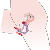 Stymulator punktu g wyeksponuj i rozchyl swoją cipkę i łechtaczkę - dsr 0503517 - 6